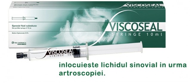 Sanatatea picioarelor - Recomandari pentru ruptura de menisc 4 viscoseal